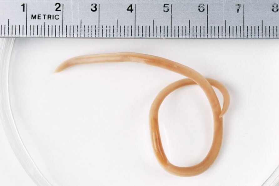 Ascaris je kulatý červ žijící v lidském těle